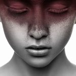 Skin burnout?